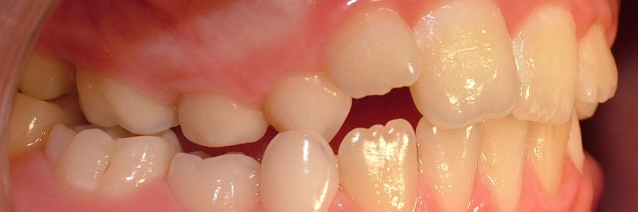 Caso Ortodoncia Simple